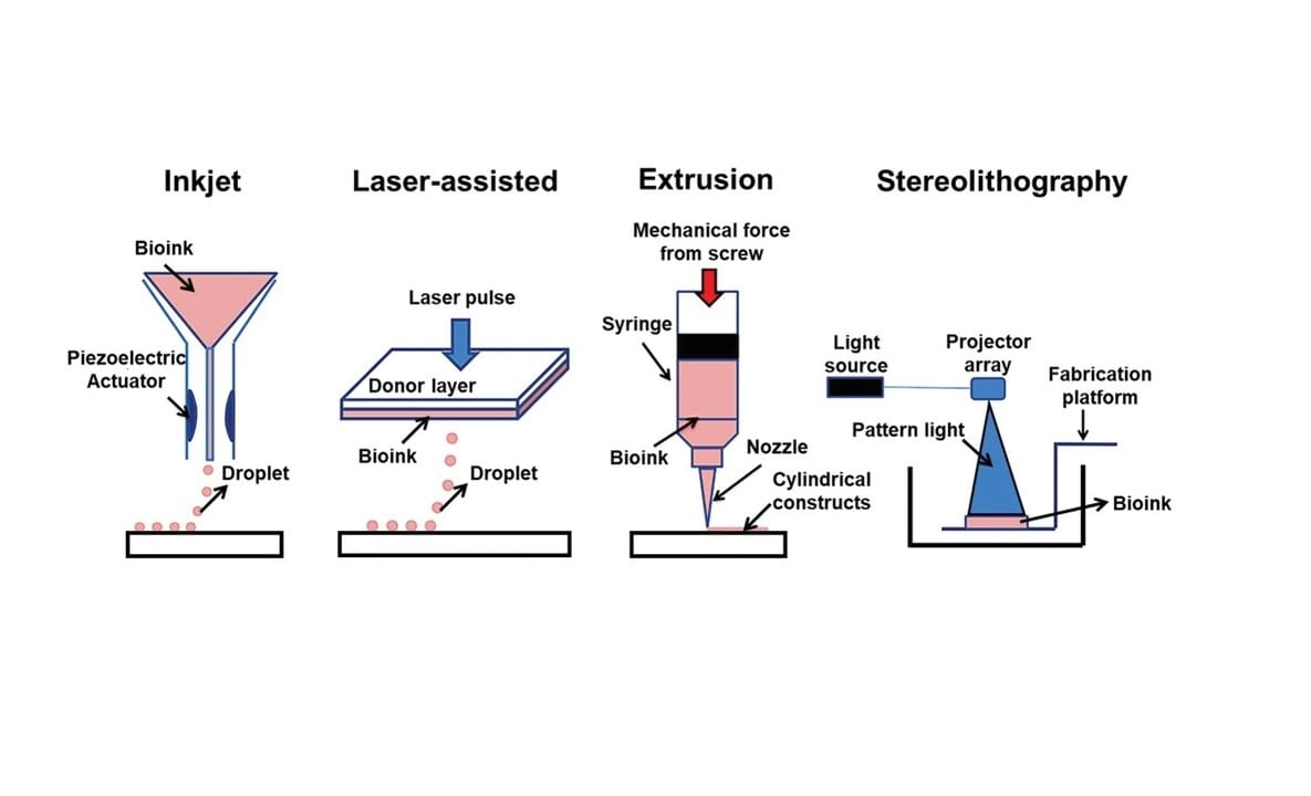 Different bioprinting techniques