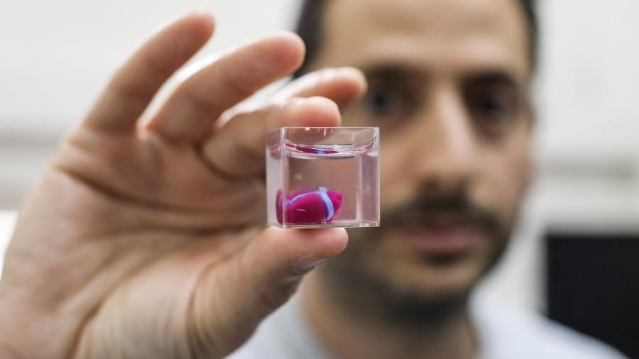 A bioprinted, fully-vascularized human heart miniature developed at Tel Aviv University in 2019