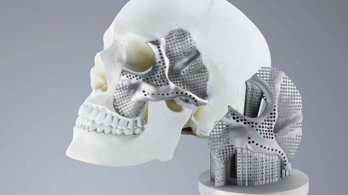 Bioprinting organs is a few decades away, but 3D printing is already contributing to the healthcare sector