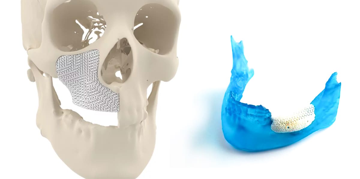 Image of 10 Most Innovative 3D Printing Companies: Cerhum