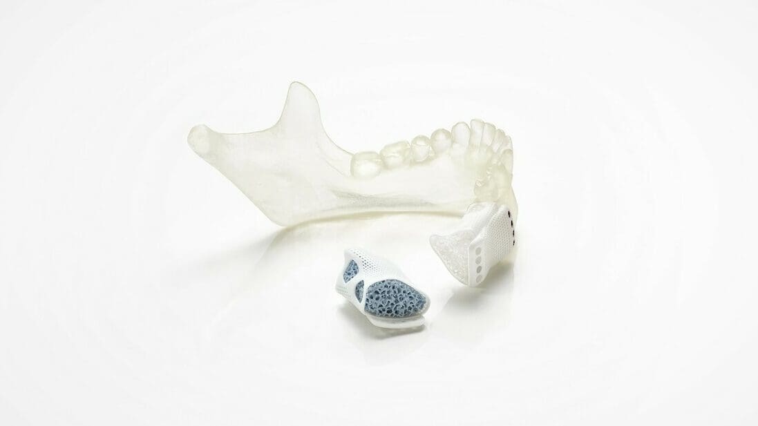 Lithoz's LithaBone HA 400 allows for bone substitute implants