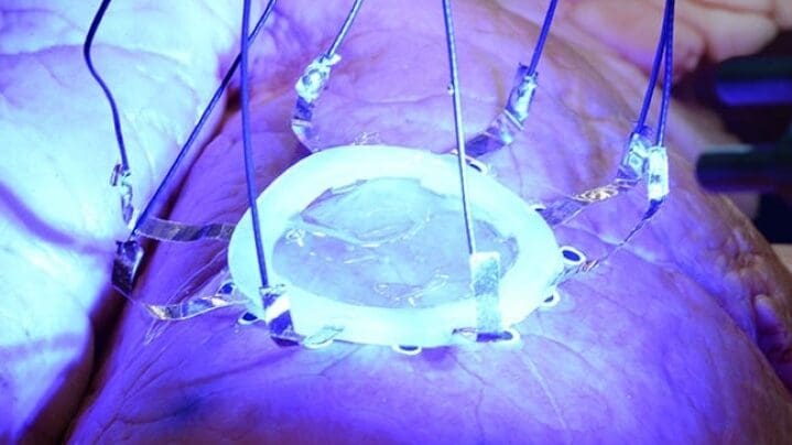 Lungs can replace the print bed