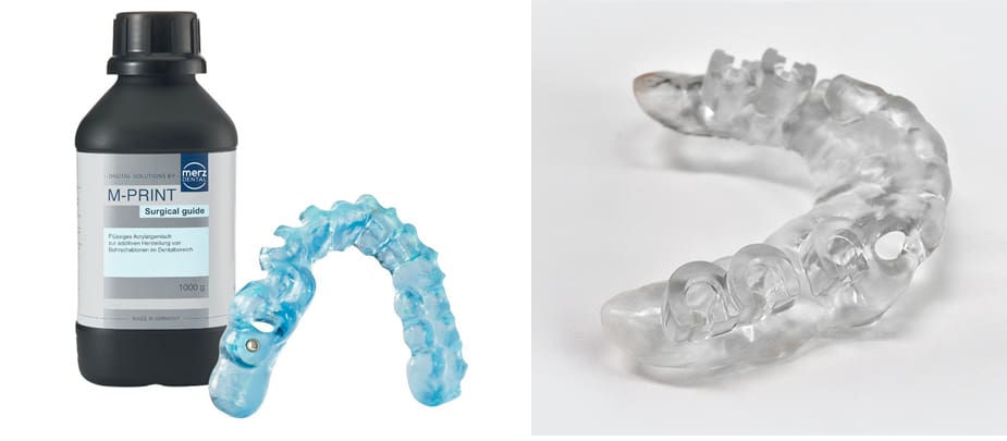 Image of Best Dental 3D Printing Resins: Surgical Guides