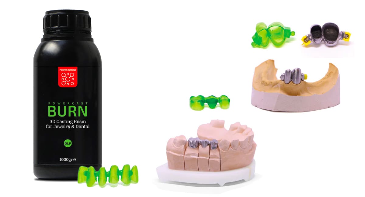 Image of Best Dental 3D Printing Resins: Castable Resins for Metal Dental Casts