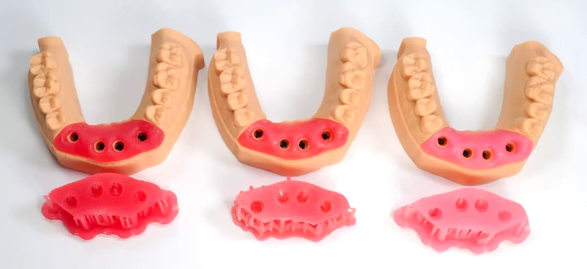 Image of Best Dental 3D Printing Resins: Gingiva Masks