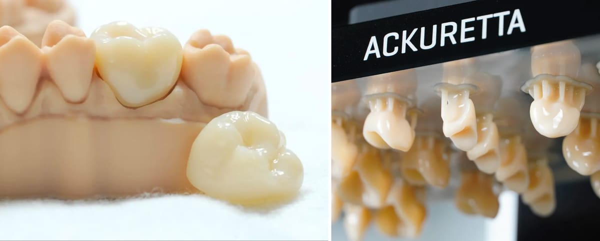 Image of Best Dental 3D Printing Resins: Crowns and Bridges