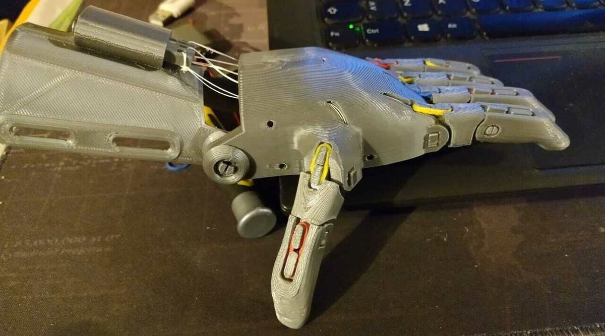 Open source prosthetics is an excellent way to minimize hand-deficient individuals