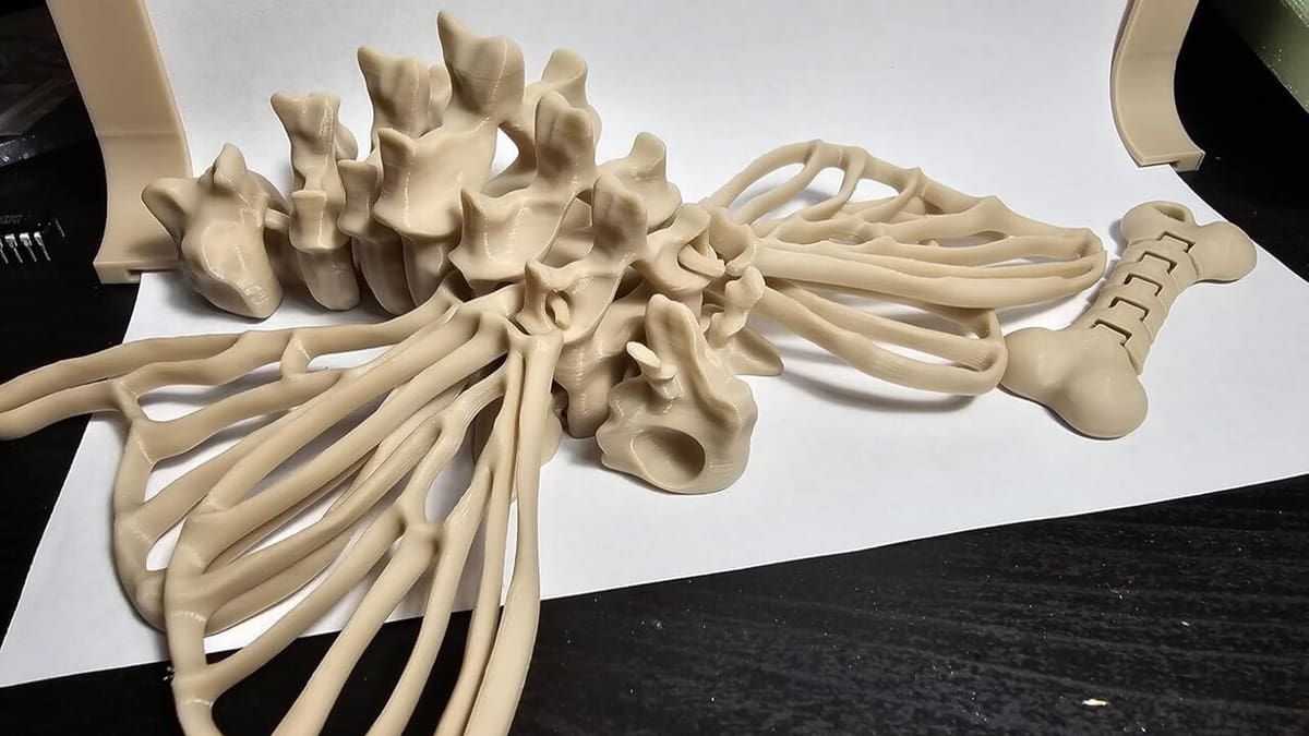 And you're saying these aren't actual bones?